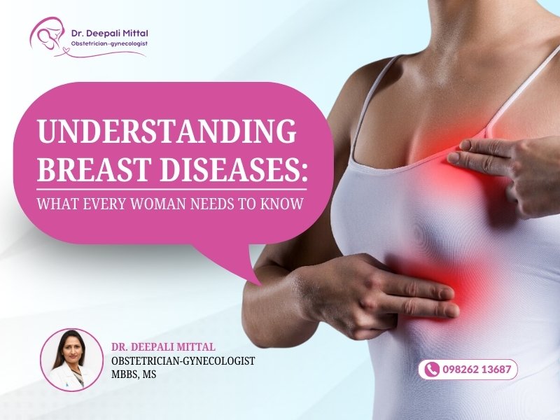 Understanding breast diseases and what every woman needs to know, explained by a Breast Disease Specialist in Indore.