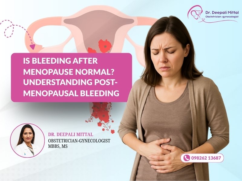 Bleeding after menopause explained by Dr. Deepali Mittal, Gynecologist in Indore.